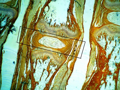 Total-25x.2