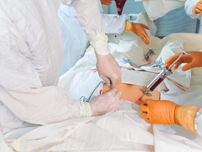 Transplante-de-medula-ossea-1600528960273_v2_4x3